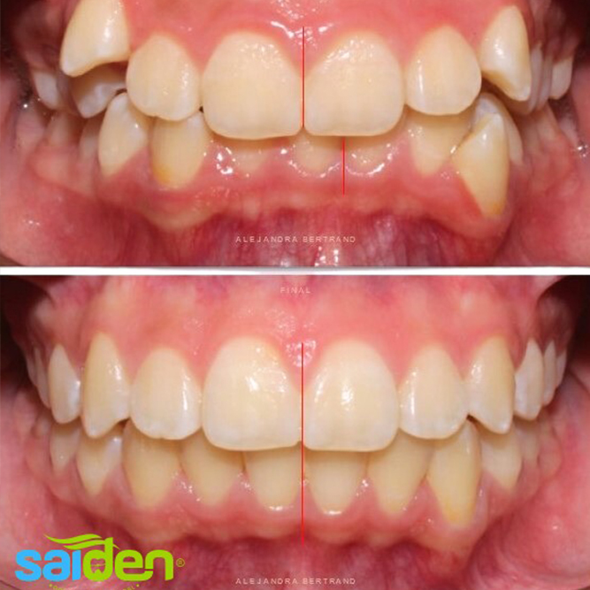 Servicio protesis dentales